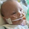 Image of baby Julian, with oxygen, a feeding tube, wrapped in fuzzy blanket.