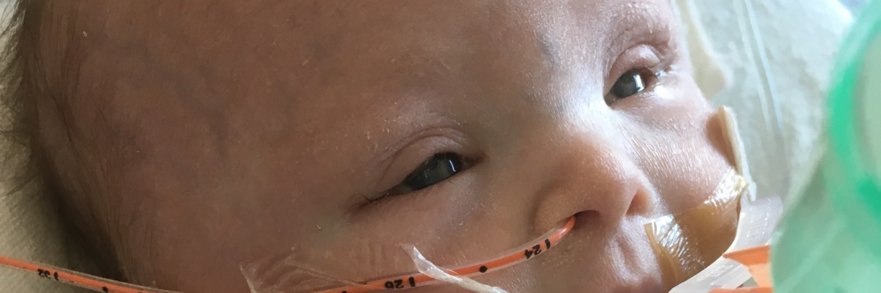 My Baby With Down Syndrome Helped Me See Each Day as a Gift Image of baby Julian, with oxygen, a feeding tube, wrapped in fuzzy blanket.