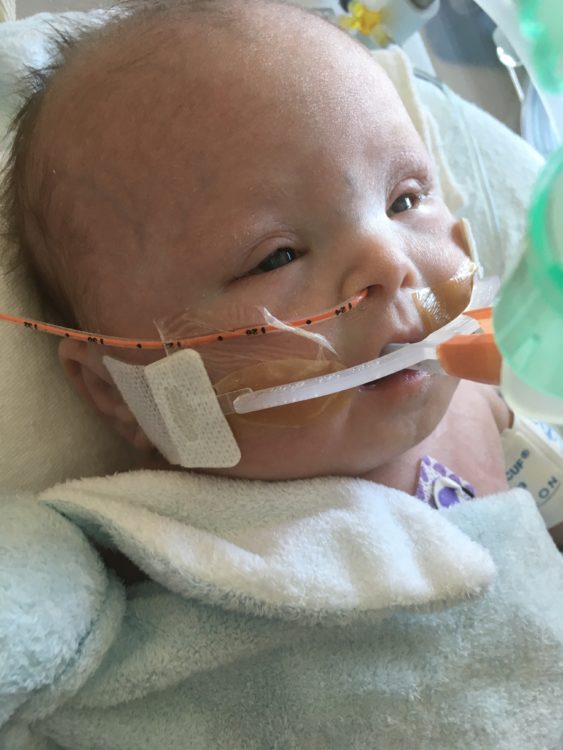 Image of baby Julian, with oxygen, a feeding tube, wrapped in fuzzy blanket.