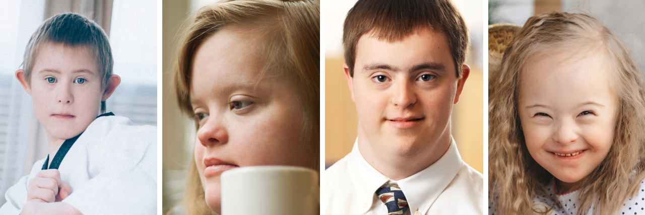 Ways People With Down Syndrome Prove Doctors Wrong