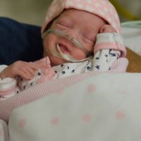 Preemie baby with oxygen and feeding tube