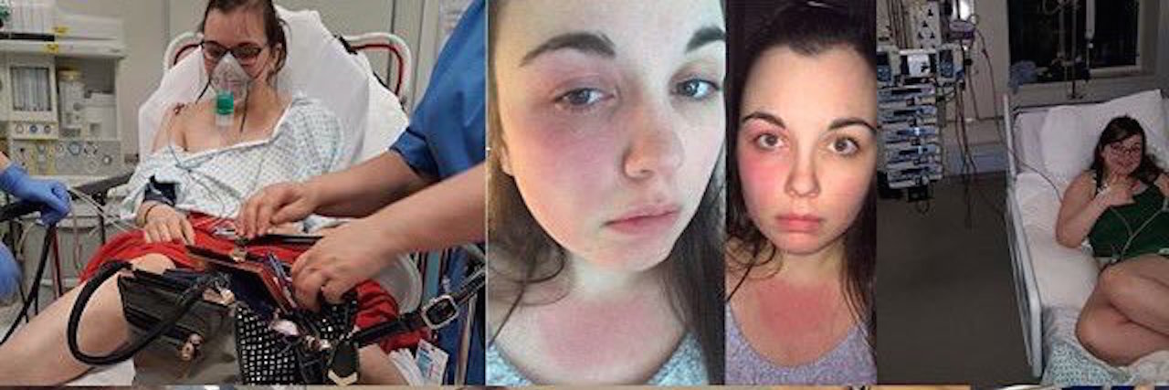 collage of photos of girl with allergies