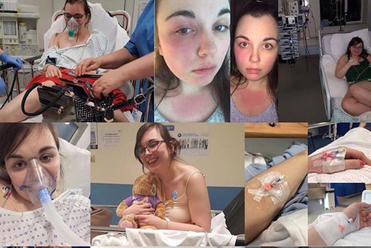 collage of photos of girl with allergies