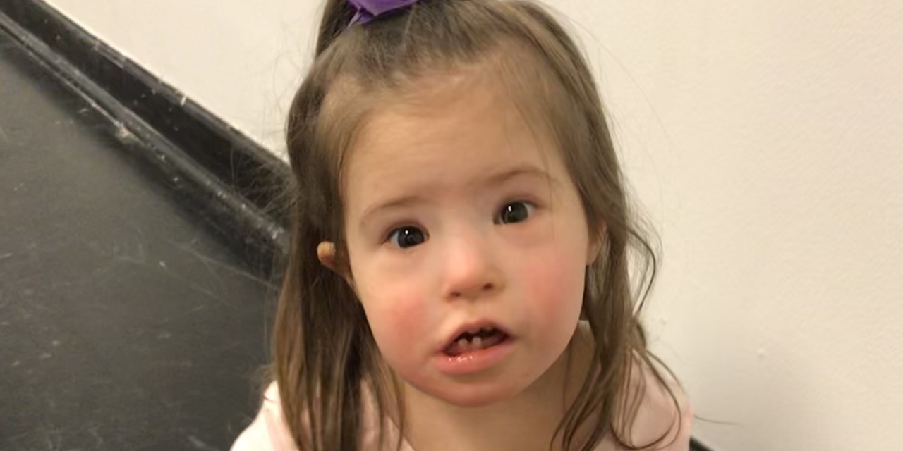 Dear Doctor You Were Wrong About My Daughter With Down Syndrome The 