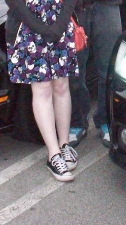 woman wearing a dress and converse. her knees are purple