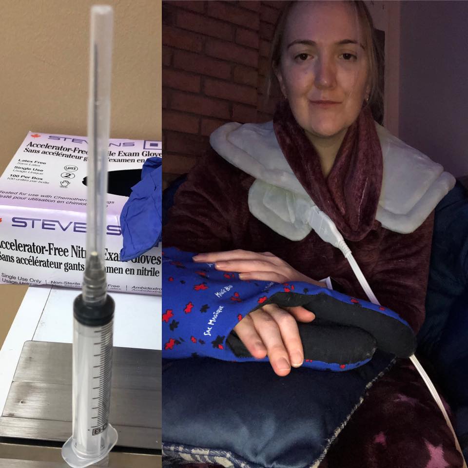 left photo: syringe and latex gloves. right photo: woman wearing a 'magic glove' with a heating pad on her arm