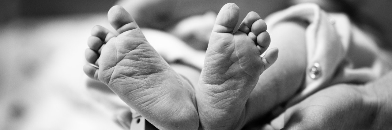 Black and white image of moms hands holding preemie baby's feet in one hand.