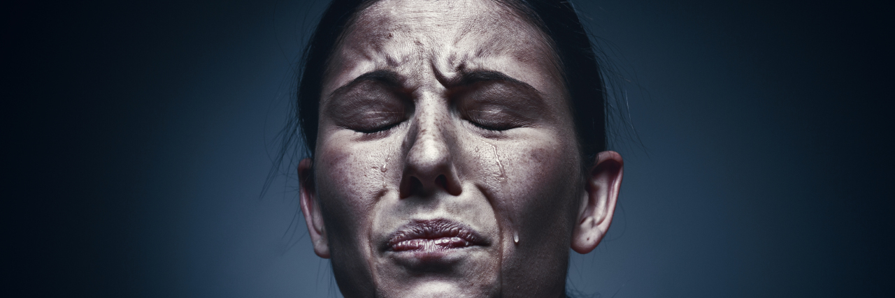Is Your Mental Illness Causing Excessive Anger? Close up portrait of a crying woman with bruised skin and black eyes at studio.