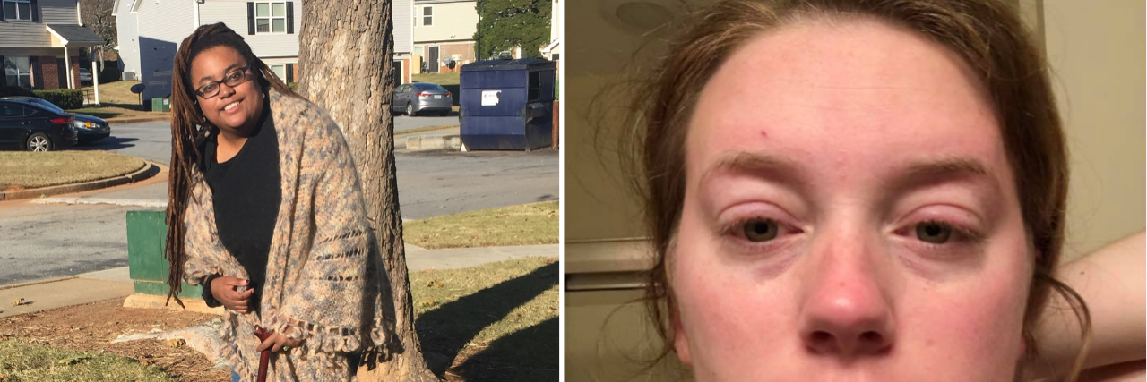 17 Photos That Reveal Sides of Fibromyalgia Flares We Don't Often See