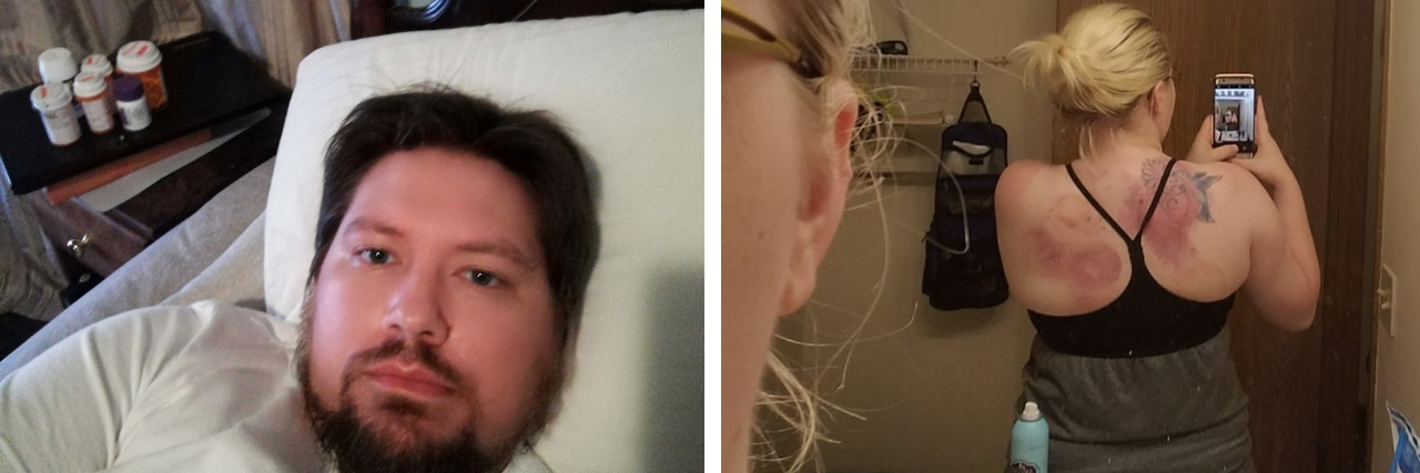 17 Photos of Chronic Pain Doctors Should See man in bed and woman selfie of back through mirror
