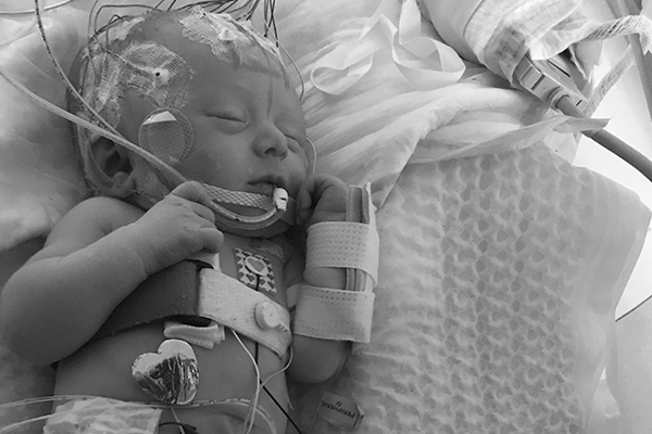 Owen in the NICU with tubes and wires.