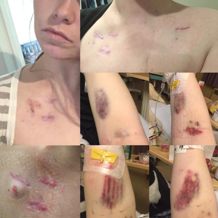 collage of photos of woman's scars