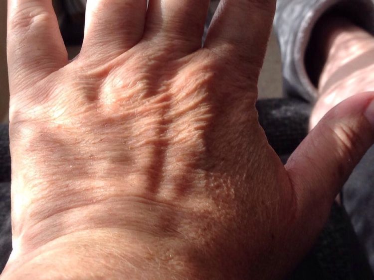 woman's hand with stretchy skin