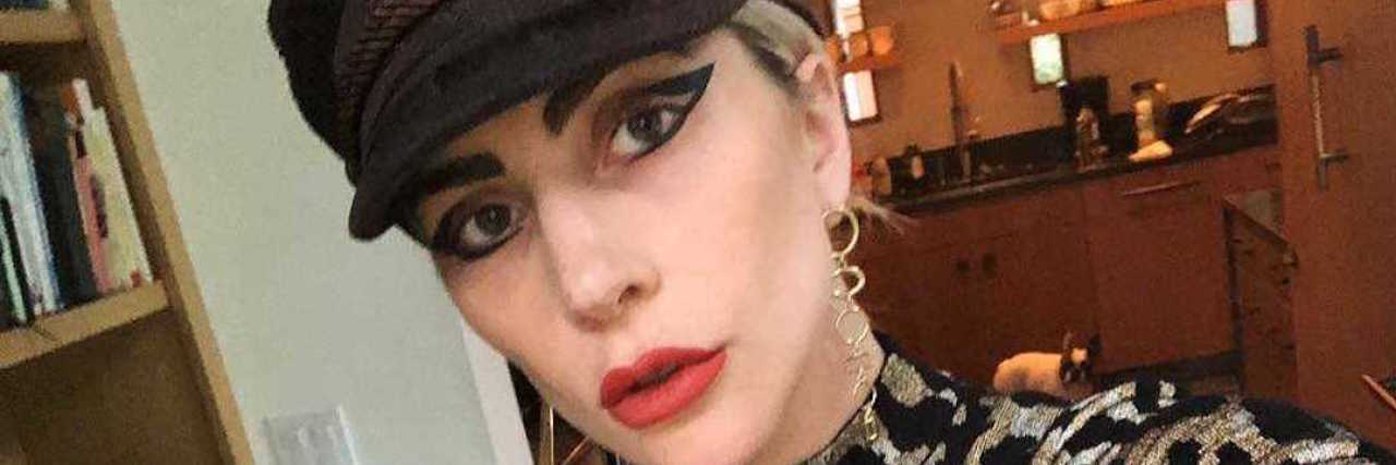 What Lady Gaga Means for Chronically Ill Women Like Me lady gaga