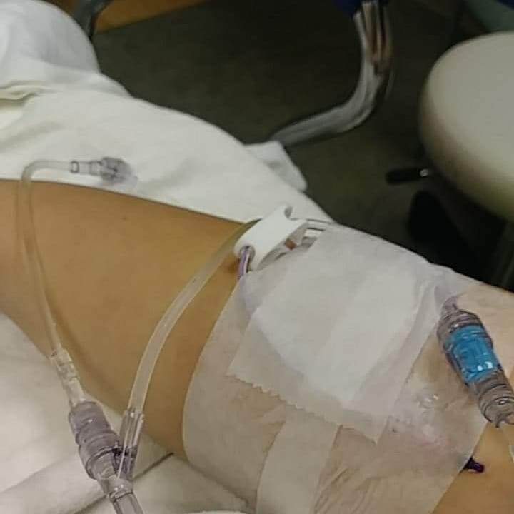 arm with iv in hospital