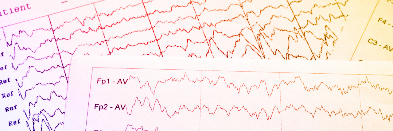 Two pages of EEG data