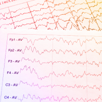 Two pages of EEG data