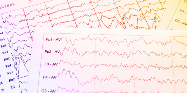Two pages of EEG data