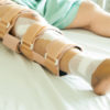 Woman wearing a leg brace after surgery.