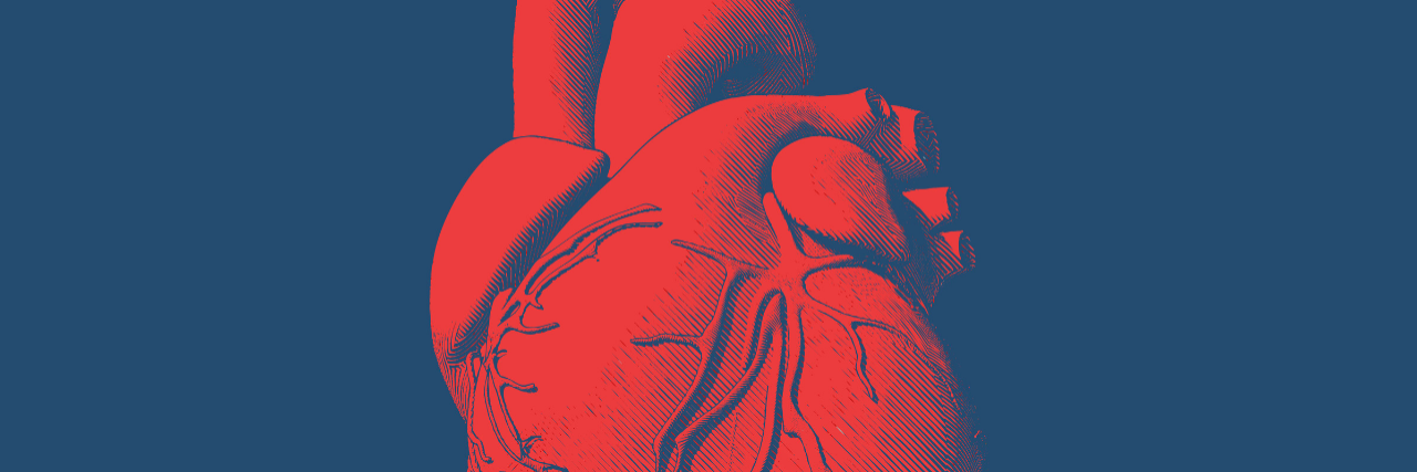 Tweet Highlights Issues in Recognizing Heart Attacks With Chronic Pain Illustration of red human heart with blue background