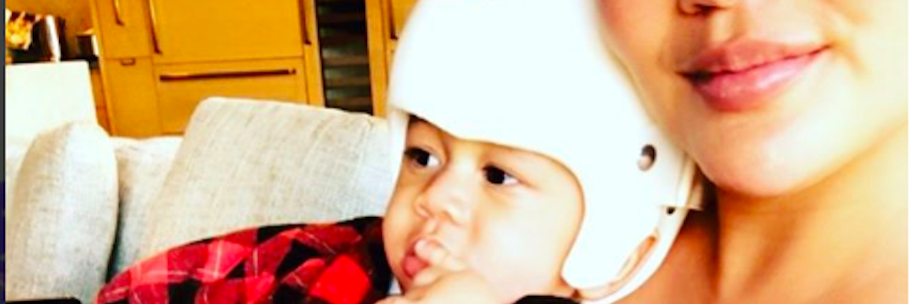Chrissy Teigen Fights Mom-Shamers Over Son's Corrective Helmet Christine Teigen Instagram photo
