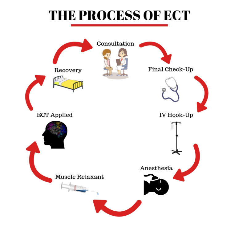 The Process of ECT flow graphic