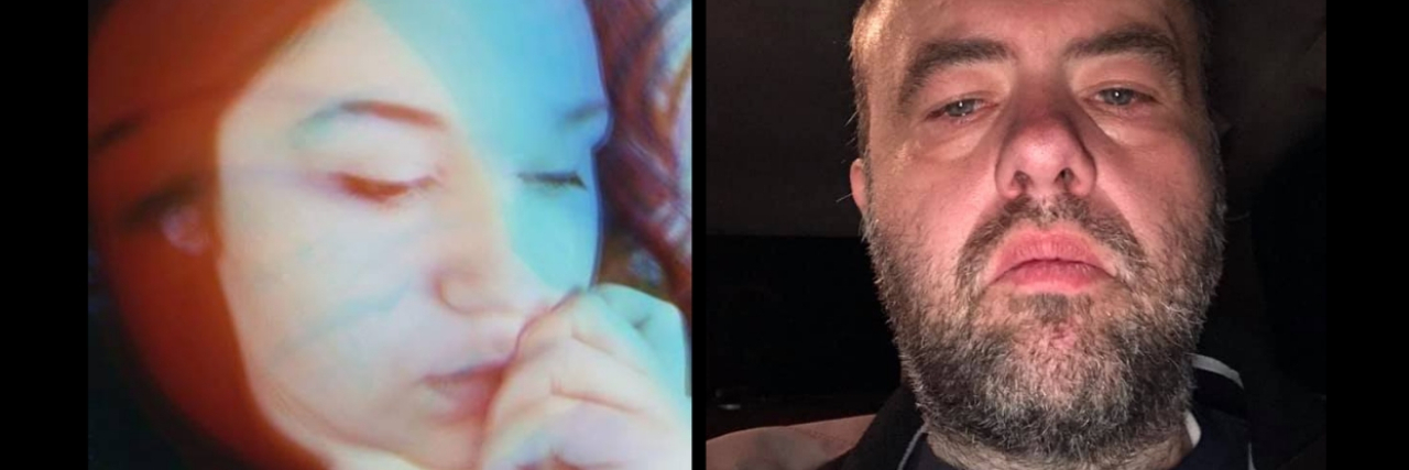 Photos of Anxiety and Depression