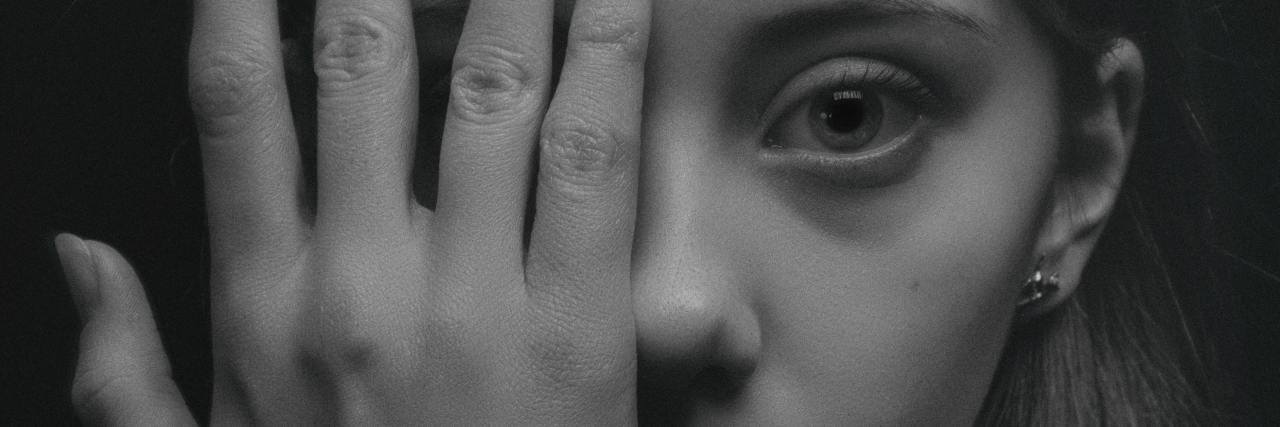 OCD Makes Me Feel Like I'm Possessed by a Monster black and white close up image of young woman covering one eye with her hand and looking scared