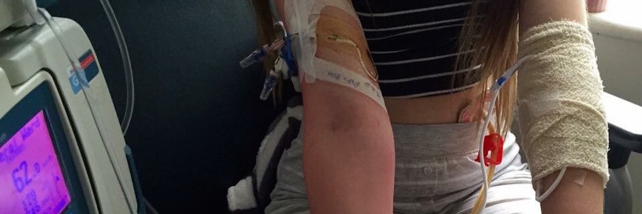 5 Emotional Stages I Faced While Starting Home Parenteral Nutrition woman showing home parenteral nutrition equipment