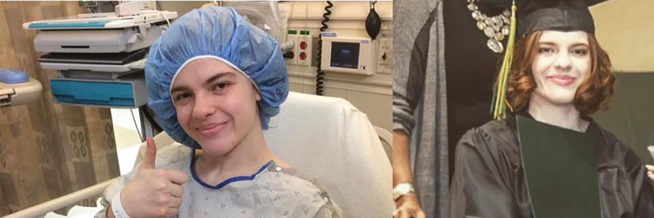 Celebrating Surgeries Years Later