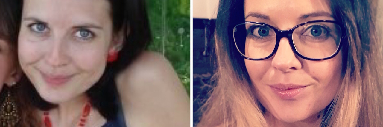 #10YearChallenge Photo Can't Show Eating Disorder Recovery The author, 10 years ago and the author now