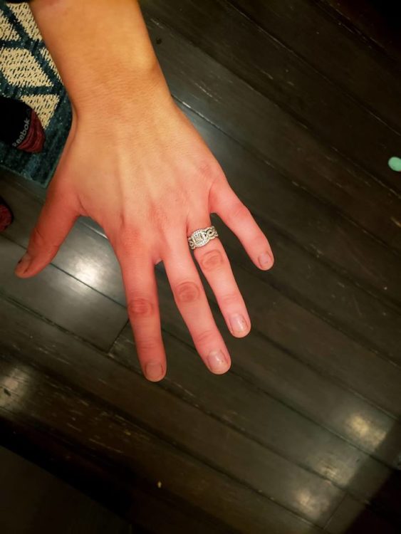 woman's hand with very red fingertips due to raynaud's