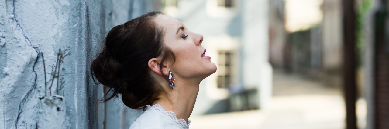 Feeling Beautiful After Receiving Compliments With Vitiligo Erika. Photo by Rachael Laurin Photography.