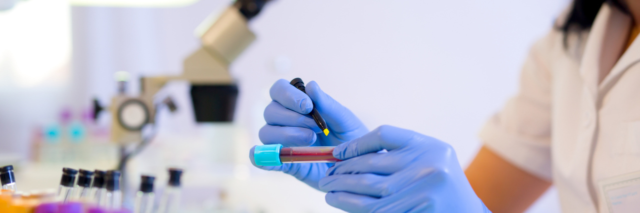 Study Finds Blood Test to Predict Alzheimer's 16 Years Before Symptoms Woman working in a laboratory. He writes with a felt pen. Selective focus