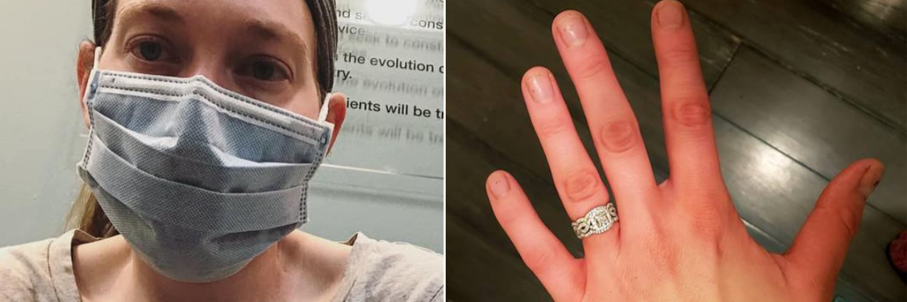 left photo: woman wearing a face mask in a doctor's office. right photo: woman's hand with red fingertips due to raynaud's