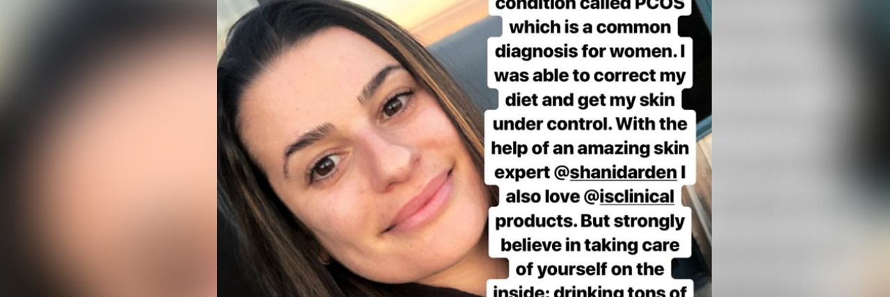 Lea Michele Shares Her Skincare Routine for PCOS on Instagram lea michele instagram post about pcos