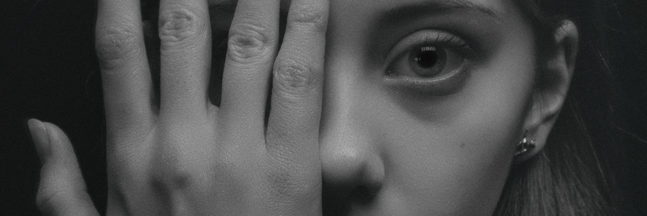 black and white photo of young woman covering one eye with hand and looking into camera