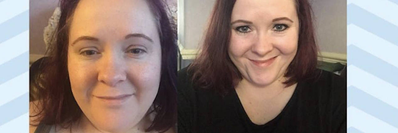 The Two Faces of My Fibromyalgia A Facebook post showing two different faces of the same woman.