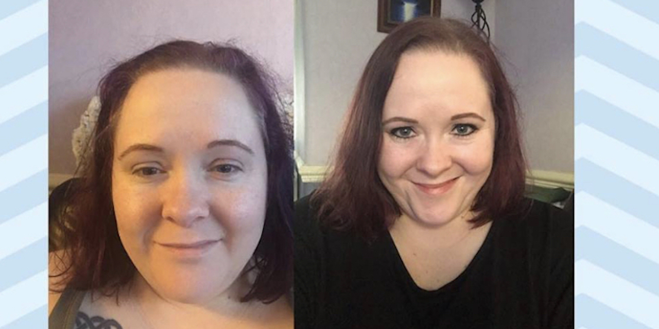 The Two Faces of My Fibromyalgia The Mighty