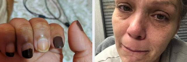 One the left, a photo of a hand with chipped nail polish. On the right, a woman who's face is crumpled in distress.