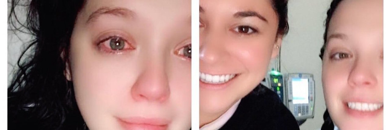 Stranger Drives to Hospital and Braids Woman's Hair Pre-Op photo of the woman in the hospital before and after having her hair braided by a stranger