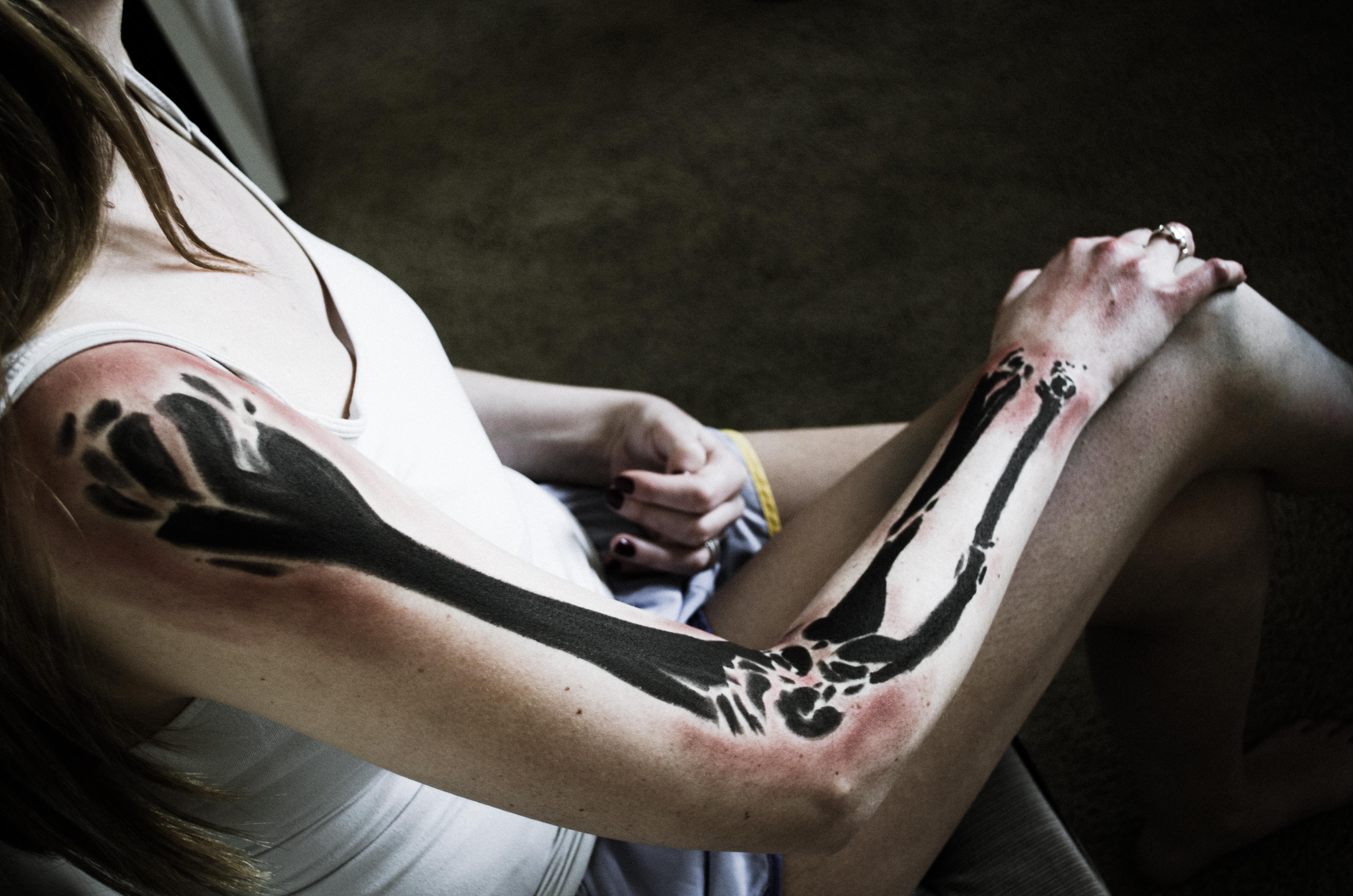 Arm makeup illustrating bone and joint pain.