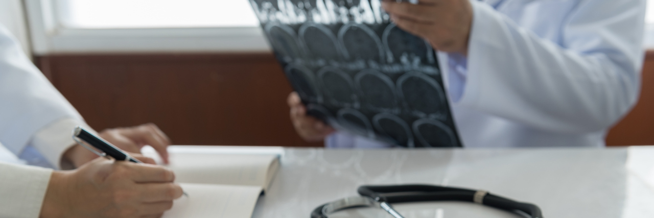 Nearly 1 in 5 Patients With Multiple Sclerosis May Be Misdiagnosed doctor looking at x-ray