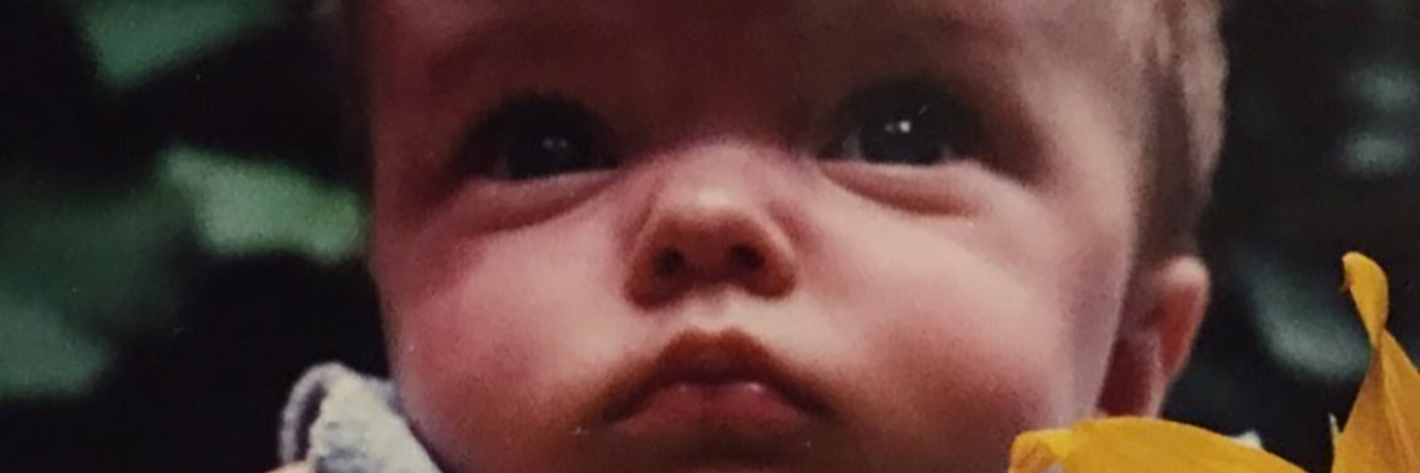 Letter to Parents Expecting a Child With Achondroplasia Sarah as a baby, holding a sunflower.