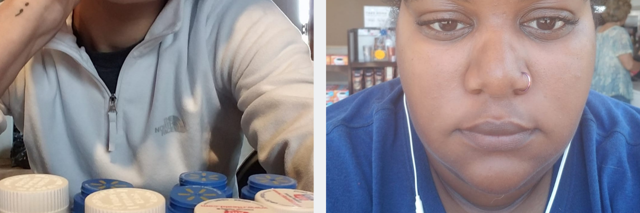 13 Photos That Show the ‘Embarrassing’ Sides of Bipolar Disorder Two different photos of women staring into the camera.