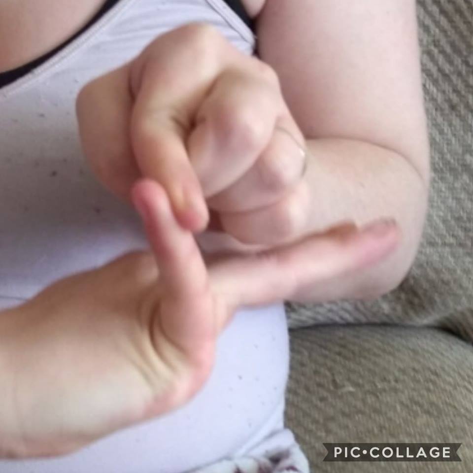 woman bending her fingers back and hyperextending them due to ehlers-danlos syndrome