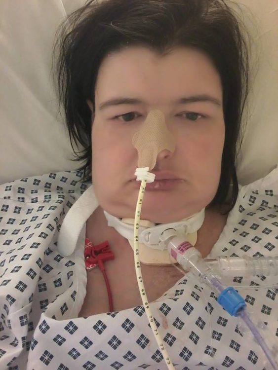 woman after coma tubes
