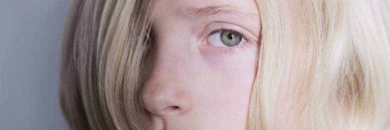 Tips for Motivating Children on the Autism Spectrum Sad teen, image with text that says: "Is your autistic child unmotivated?"