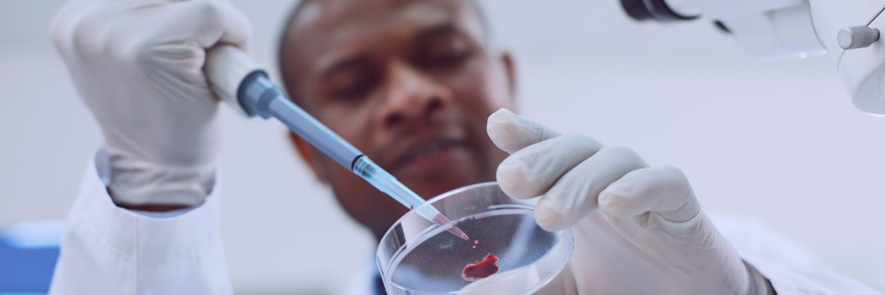 New Ohio State Research May Lead to a Reliable Fibromyalgia Blood Test Delighted skilled scientist conducting a blood test and wearing a uniform