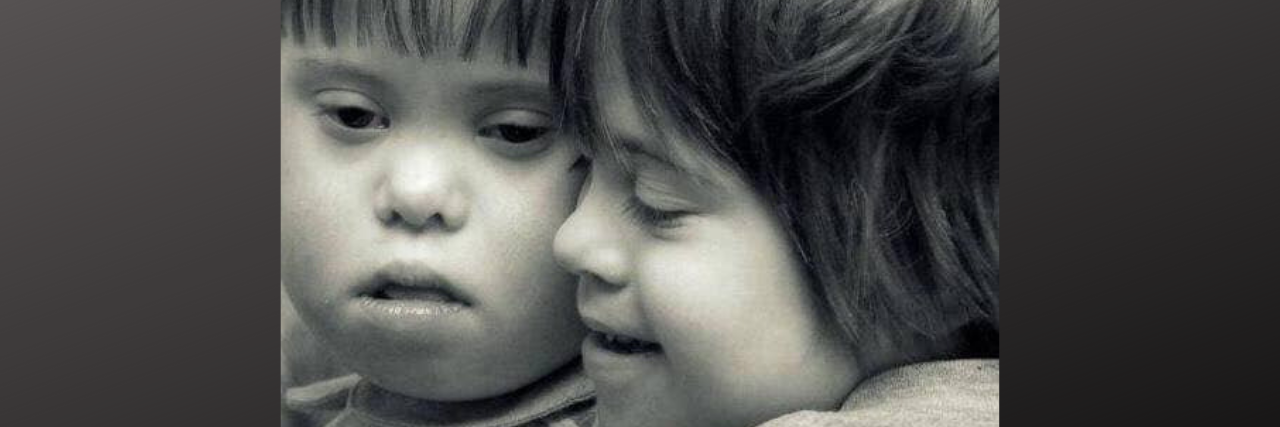 Celebrating People With Down Syndrome Regardless of Accomplishment Black and white image of two kids with Down syndrome